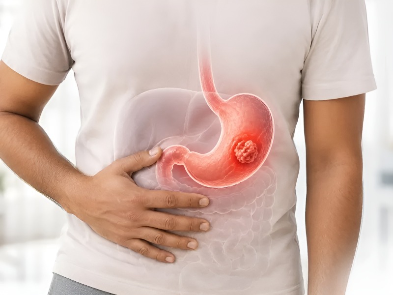 Gastrointestinal Surgery