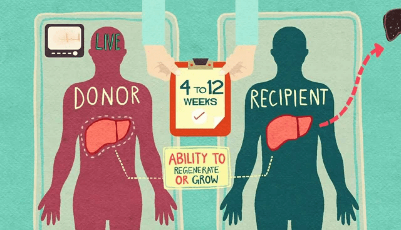 Awareness About Liver Transplant