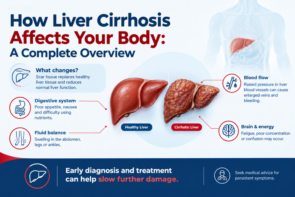 How Liver Cirrhosis Affects Your Body: A Complete Overview How Liver Cirrhosis Affects Your Body: A Complete Overview